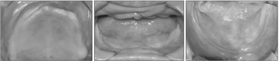 Fig. 2. Intraoral photo at first visit.