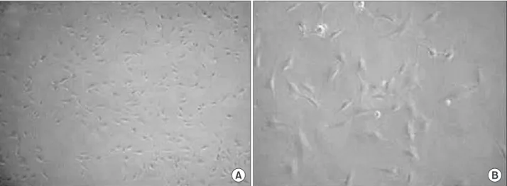 Fig. 1.  Microphotographs show MC3T3-E1 mouse osteoblastic cells (Von Kossa staining); (A) ×40, (B) ×100.