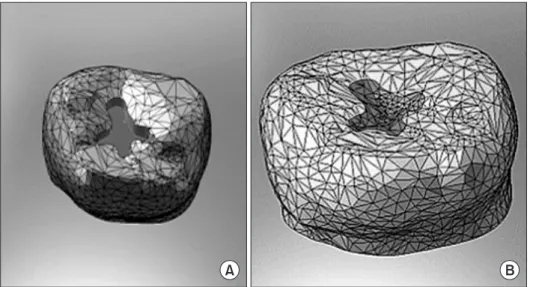 Fig. 2. Generation of 3-dimensional model of individual teeth using  MIMICS software. Details were corrected to yield relatively smooth  surface using 3-dimensional edition function