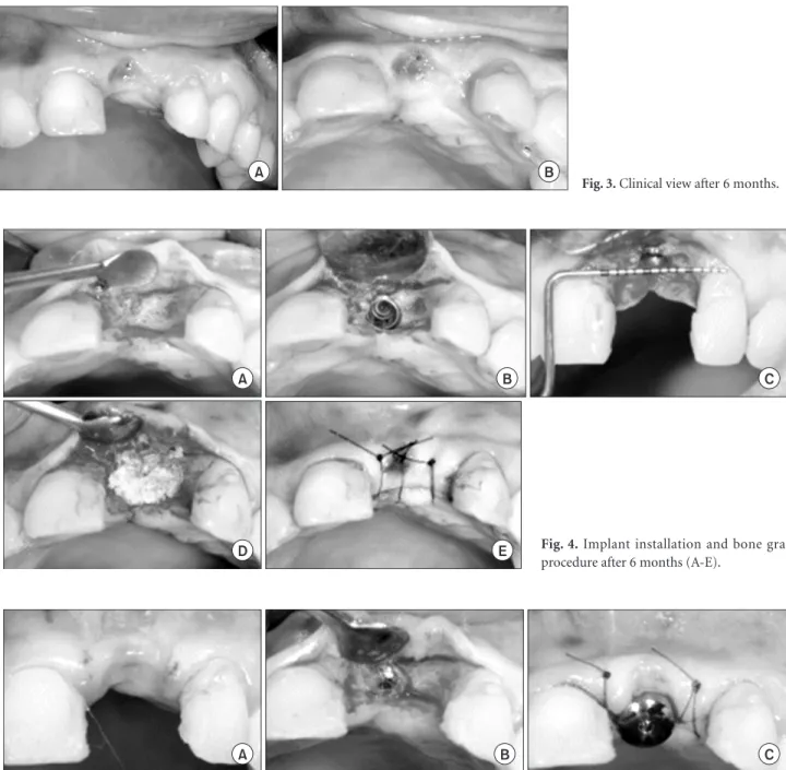 Fig. 3. Clinical view after 6 months.
