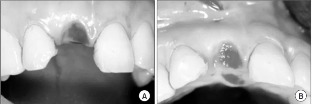 Fig. 9. Clinical view after 9 months.