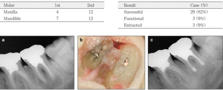 Table 1. Distribution of molars
