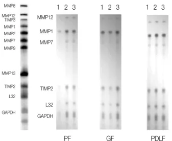 Figure 2. RNase  Protection  Assay  24  hours  after stimulation with Mock and Substance P.