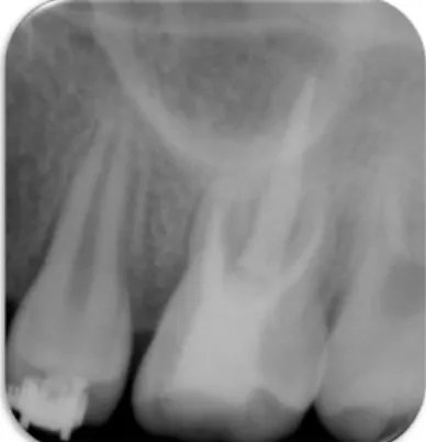 Figure 9. 6 month follow up-conebeam CT image. CT, computed tomograph.