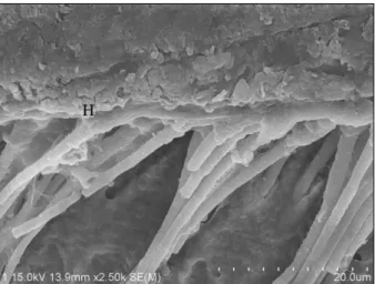 Figure 2. Scanning  electron  microscophic  photograph showing the wide gap (G) and few short and slender resin tags in Group 2.