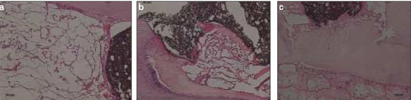 Figure 4. a. Pulp capping with Dycal at 7 days. Pulp tissue degeneration was seen. b. Pulp capping with Dycal at 30 days.