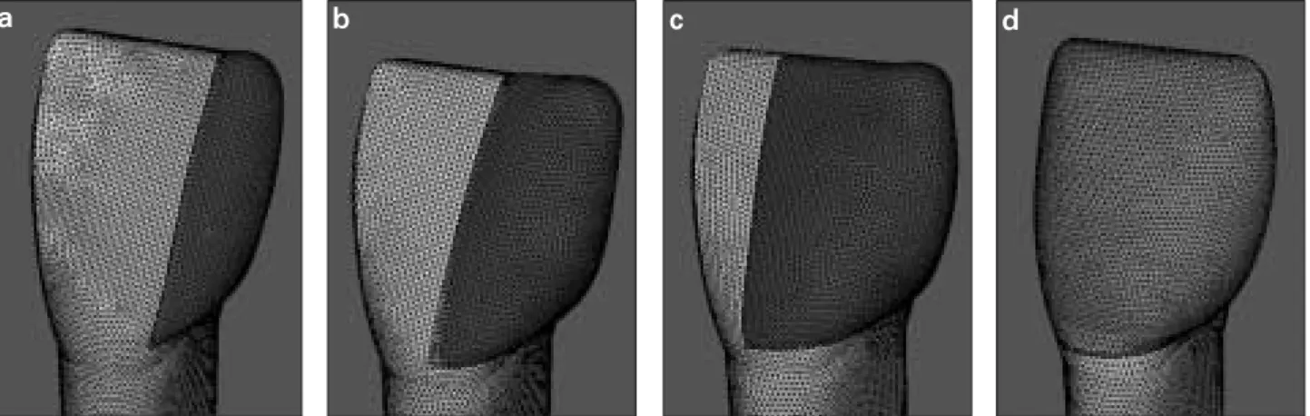 Figure 1. Finite element models of each type of restorations. a. Type I, b. Type II, c