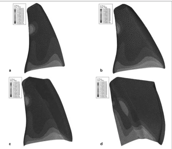 Figure 3. von Mises stress distribution patterns of each type of restoration. These figures represent stress distribution at the tooth side of bonding layer