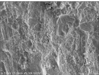 Figure 1. SEM  micrograph  of  dentin  side  showing  a representative  cohesive  failure  within  Panavia  F  2.0  (×