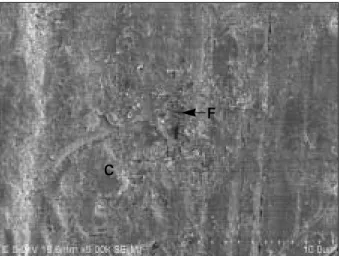 Figure 6. SEM  micrograph  of  dentin  side  showing  a representative  adhesive  failure  of  BisCem  along  dentin surface (× 130)