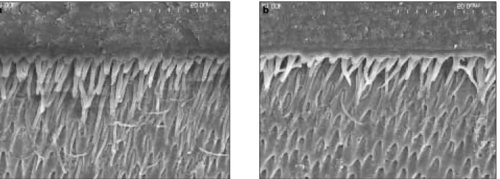 Figure 1. SEM micrograph of the bonded interfaces treated with 6 N HCl and 3.5% NaOCl of MP group