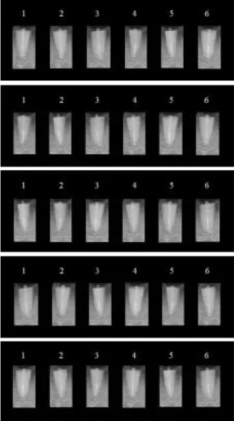 Figure 4. Radiographic image of posts.