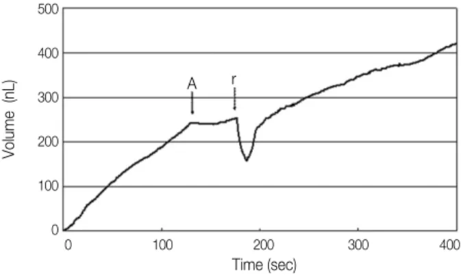 Figure 5. A representative curve of consecutive DFF during SuperSeal application. Upward (positive slope) movement vs  time  on  graph  indicates  outward  DFF,  whereas downward  (negative  slope)  movement  indicates  inward DFF