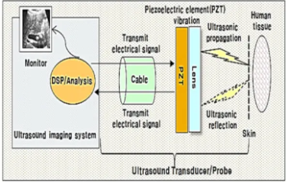 그림 2. 수지형체외식초음파프로브의 구성 Fig. 2. The  composition  of  ultrasonic  probe