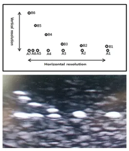 그림 9. 분해능 시험 결과 Fig. 9. Resolution  test  result2.5.3  분해능  시험분해능 시험은 초음파 트랜스듀서의 측정 분해능을 조사하는 시험으로 다음의 시험기준을 만족해야 한다.(1)  시험 기준①  수직분해능은 2  mm  이하 또는 제조사가 제시하는 값을 만족해야 한다.②  수평분해능은 3  mm  이하 또는 제조사가 제시하는 값을 만족해야 한다.(2)  시험 기기다용도  측정용  초음파  팬텀  (Multi-Purpo
