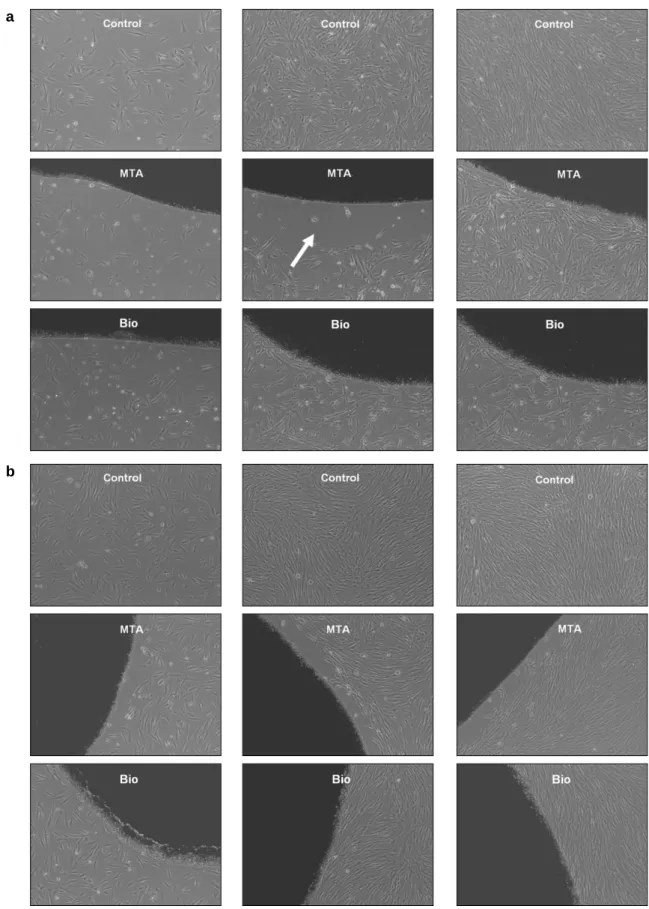 Figure 1. Photos taken from an optical microscope (×40 magnification). The same number of cells (a, human pulp cells; b, PDL cells) were seeded to MTA or Bioaggregate coated cell culture dishes, then initial attachment was observed using a phase microscope