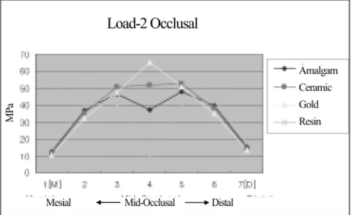 Figure 14. The  maximum  principal  stress  analysis  stress distribution along central groove of occlusal groove under Load-2.Load-2 PalatalAmalgamCeramicGoldResin
