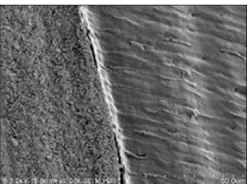 Figure 6. SEM  photograph  showingthe  close  adapta- adapta-tionofthedentin-resincement interface by Group 5 (Isodan + All-Bond SE).