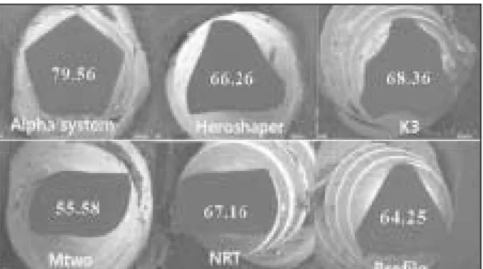 Figure 2. Standard  deviation  and  mean  values  of  time  to fracture of 6 Ni-Ti files (second)