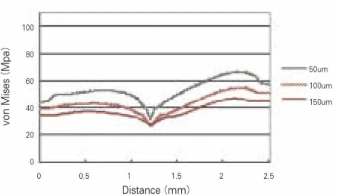 Figure 6. Principal stress vectors on adhesive when buccal loading applied