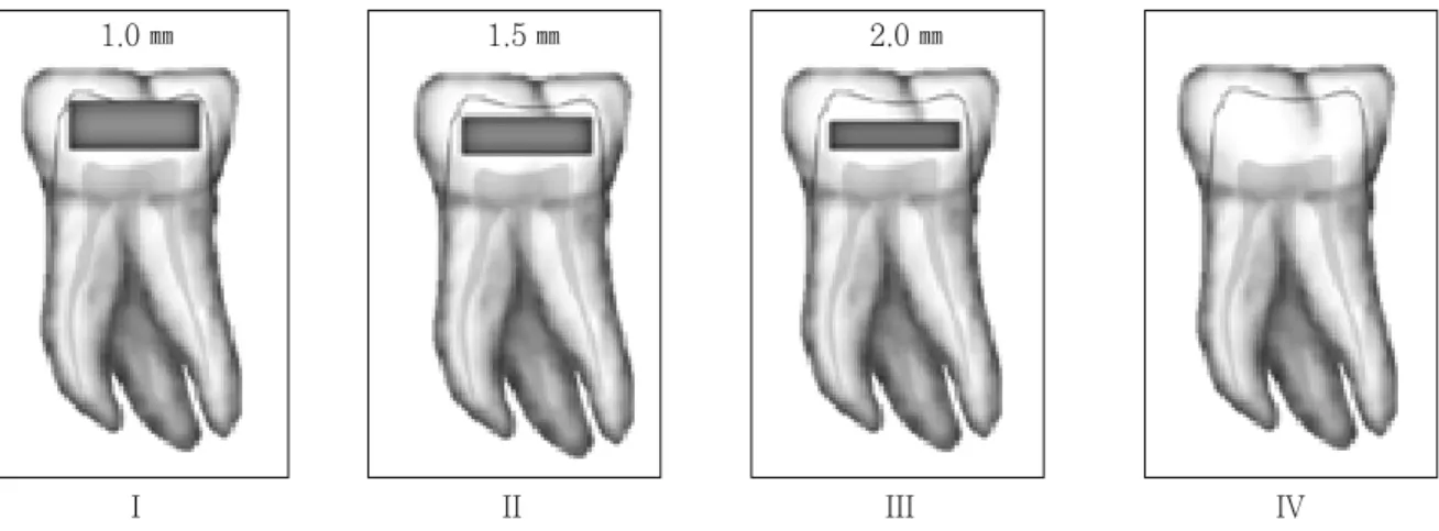 Figure 1.  Schematic drawing of cavity form.