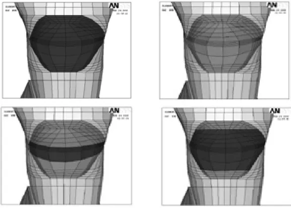 Figure 2. Simulated  restorations  of  notch-shaped  NCCL  (Upper  left;  Z100-dark  brown,  Upper right; Tetric Flow-light brown, Lower left; Combination 1, Lower right; Combination 2).