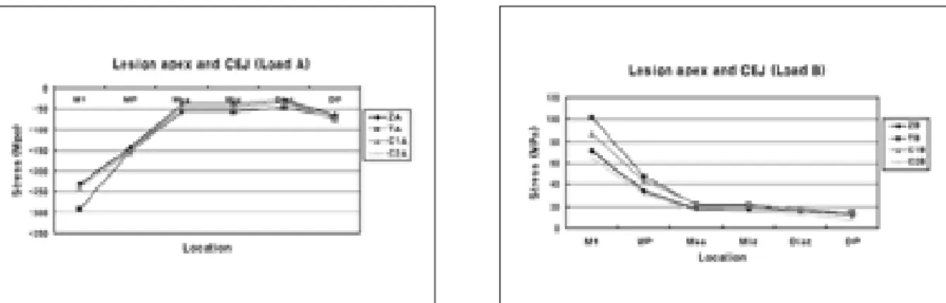 Figure 10. The compressive and tensile stress distribution on lesion apex and CEJ after restoration under Load B (MP: Mesial point angle, DP: Distal point angle, Mes: Mesial node, Mid: Middle node, Dist: Distal node).