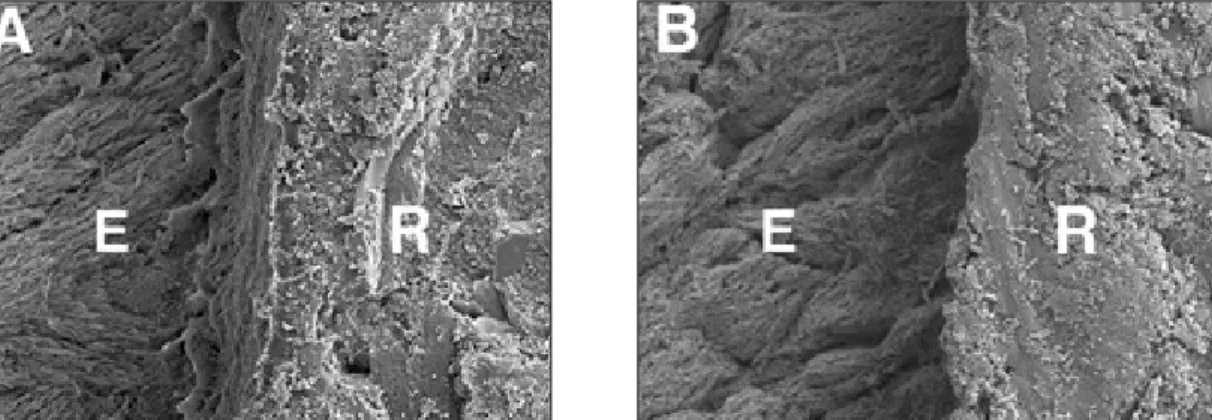 Figure 2.  SEM micrographs of interface of enamel (E) and composite resin (R) treated with Tyrian SPE for normal application time (20 s) and two times of application time (40 s)