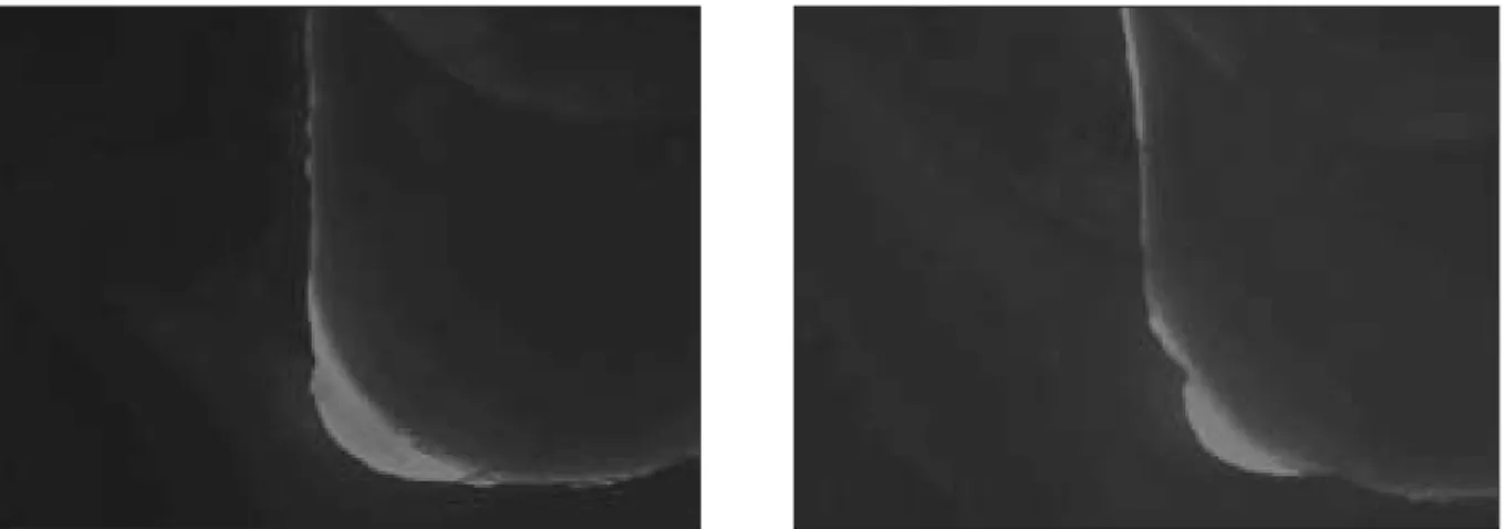 Table 4 shows the results of adhesive thickness at  the  specific  area  in  two  dentin  bonding   sys-tems