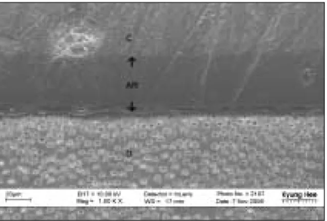 Figure 10. The  cross-sectional  SEM  photograph  of bonded surface of SB group (× 3,000)