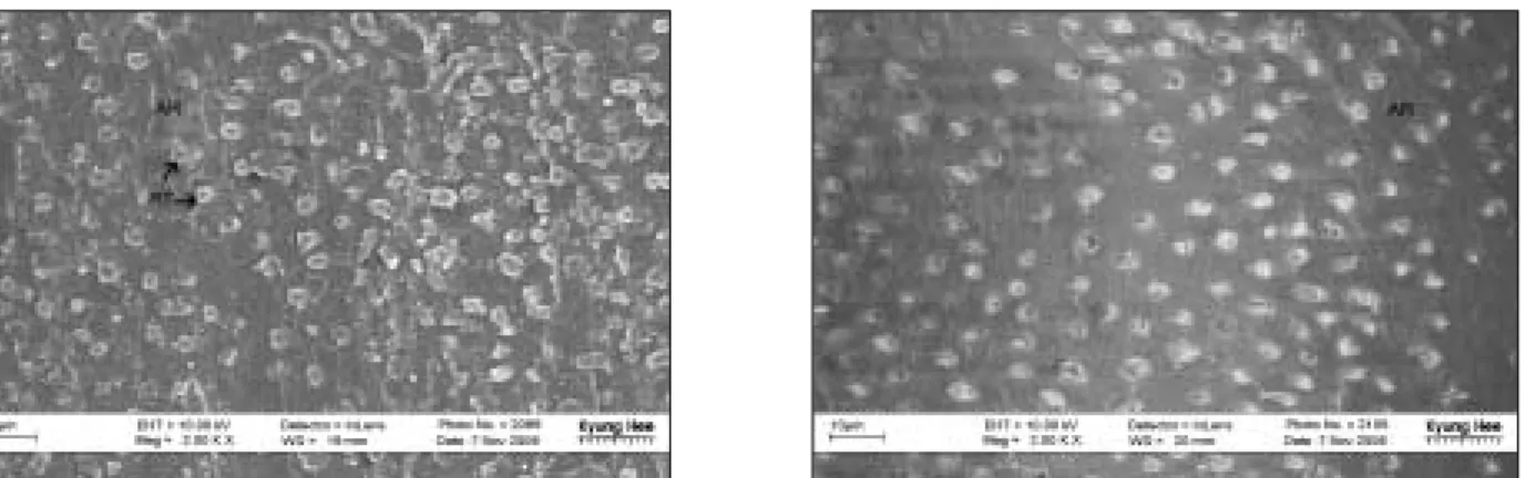 Figure 15. The resin surface (left) and dentin surface (right) of fractured SB group (× 2,000)