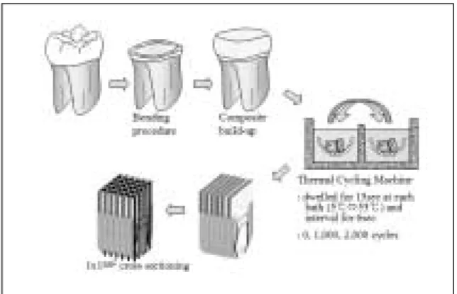 Figure 1. Specimen  preparation  for  microtensile  bond testing.  Composite  bonding  on  dentin  surface  and vertical slice with 1 ㎜ thickness