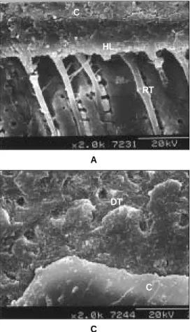 Figure 8. The adhesive interfaces bonded with AD. 