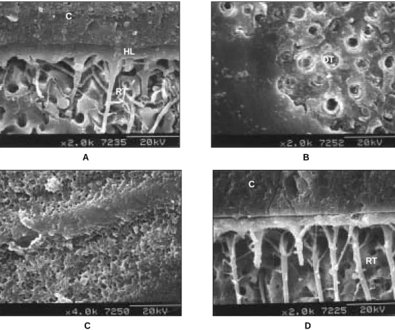 Figure 9. SEM image of interfaces bonded with single-step adhesives. 
