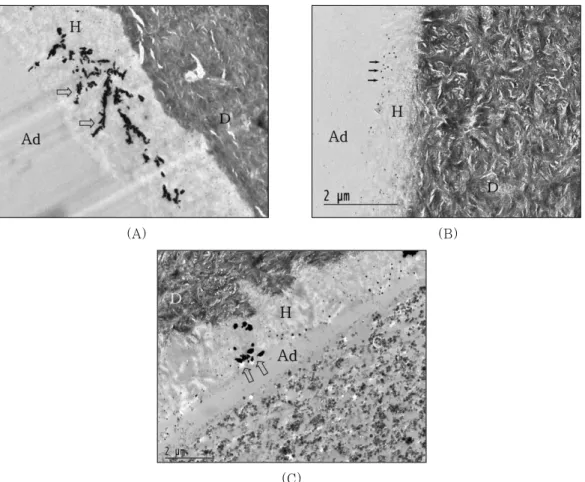Figure 5A showed the resin-dentin interfaces ofFigure 3. Undemineralized,  unstained  TEM  micrographs  of  the  resin-dentin  interfaces  of  the  single-stepadhesives with light-cure mode composite