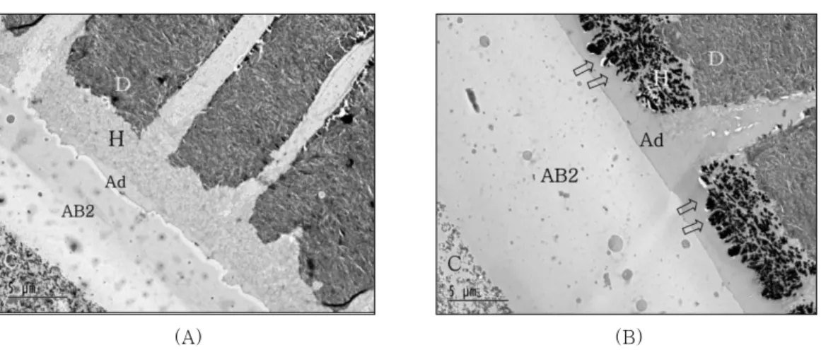 Figure 5.  TEM  micrographs  of  the  resin-dentin  interfaces  of  Prompt  L-Pop  bonded  with  self-cured composite after intermediate resin layer (IRL-AB2) applied