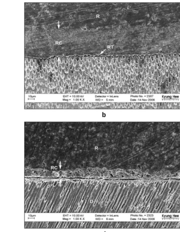 Figure 8.  FE-SEM photograph illustrating the resin/dentin interface (× 1000).