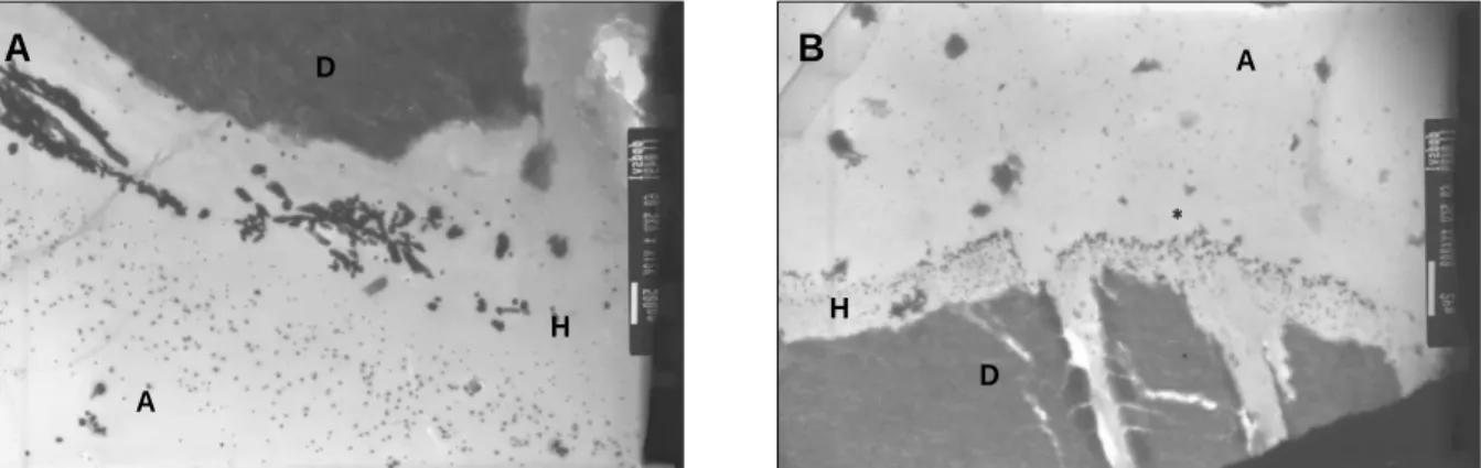 Figure 3. TEM micrographs of SR-LN. A. High magnification of hybrid layer. ‘Water-tree’structure was observed (pointer)