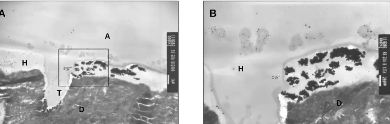 Figure 4.  TEM micrographs of SR-LY. A. Localized concentration of nanoleakage( ‘water-tree’)