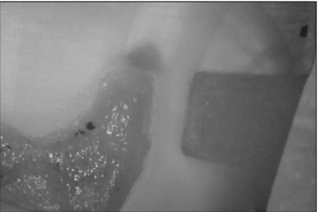 Figure 2.  A  Specimen  of  EX2  showed  score  0  at enamel margin and score 2 at dentin margin