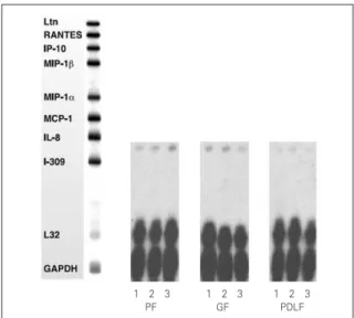 Figure 1. RNase  Protection  Assay  4hrs  after stimulation  of  the  cells  with  MOCK  and  various dose of Substance P.