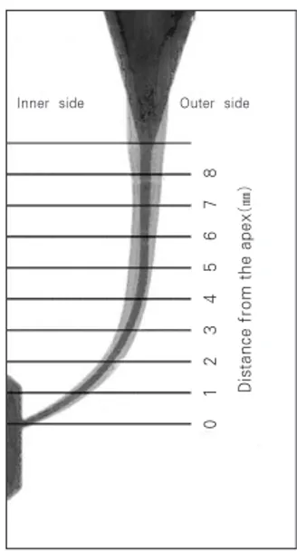 Figure 2. The diagram indicates the points at which the canal width was measured after superimposition of  pre-instrumentation and post-pre-instrumentation image.