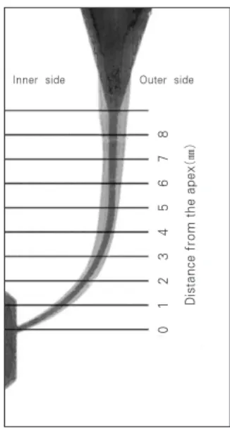 Figure 2. The diagram indicates the points at which the canal width was measured after superimposition of  pre-instrumentation and post-pre-instrumentation image.