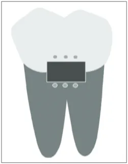 Figure 1. Schematic drawing of cavity and hemi-sphere indents.