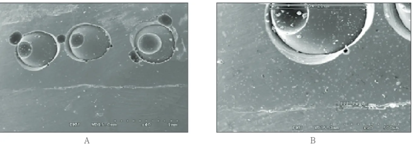 Figure 2.  Outer marginal adaptation from SEM evaluation: SEM image of outer marginal adaptation (A), mesuring length of full outer margin and marginal gap (B)