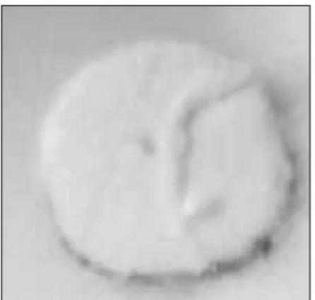 Figure 2.  Representative photograph of the group without All-Bond 2. Level 1 ( × 40)
