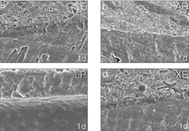 Figure 2.  SEM photographs showing the close adaptation of dentin-resin interface produced by Clearfil SE Bond (SE), AdheSE (AD), Adper Prompt L-Pop (LP), and Xeno III (XE) after 1-day distilled water storage (× 1000)