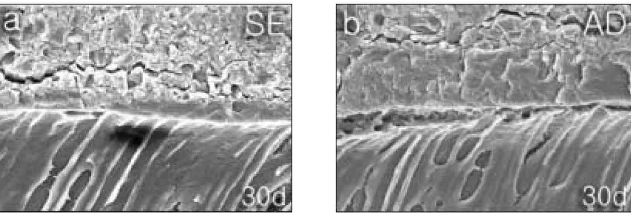 Figure 5. SEM photographs showing wide gap between the dentin-resin interface produced by Adper Prompt L-Pop (LP), and separate pattern between the interface of resin and adhesive layer produced by Xeno III (XE) after 30-day distilled water storage (× 1000