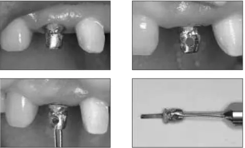 Figure 2-A.  Diagnostic intraoral radiograph. 
