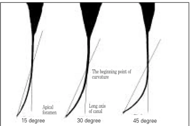 Figure 1.   The  three  different  angles  of  curvature  (by Schneider method). 